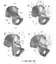 Fig. 12 - SURGICAL GUIDES AND METHODS FOR MANUFACTURING THEREOF