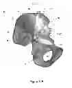 Fig. 13 - SURGICAL GUIDES AND METHODS FOR MANUFACTURING THEREOF
