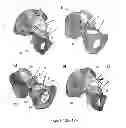 Fig. 14 - SURGICAL GUIDES AND METHODS FOR MANUFACTURING THEREOF