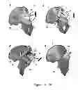 Fig. 15 - SURGICAL GUIDES AND METHODS FOR MANUFACTURING THEREOF