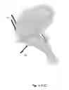 Fig. 18 - SURGICAL GUIDES AND METHODS FOR MANUFACTURING THEREOF
