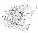 Fig. 01 - Guide tool for resection of patellofemoral joint
