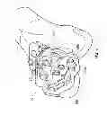 Fig. 09 - Guide tool for resection of patellofemoral joint