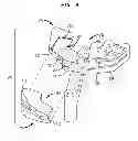 Fig. 06 - High tibial osteotomy guide