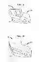 Fig. 07 - High tibial osteotomy guide
