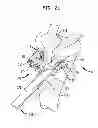 Fig. 19 - High tibial osteotomy guide