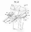 Fig. 20 - High tibial osteotomy guide