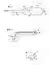Fig. 02 - Shockwave catheter system with energy control