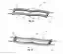 Fig. 02 - Skin tensioning devices and methods of their use