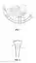 Fig. 02 - Navigation instruments for subchondral bone treatment