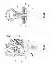 Fig. 16 - Needle harvesting devices, systems and methods