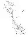 Fig. 02 - Methods for applying surgical staples to internal walls of hollow tissue organs