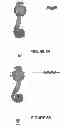Fig. 07 - Apparatus and method for forming incisions in ocular tissue