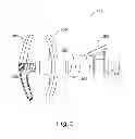 Fig. 06 - Inflator for dilation of anatomical passageway