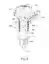 Fig. 07 - Inflator for dilation of anatomical passageway