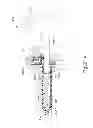 Fig. 22 - Inflator for dilation of anatomical passageway