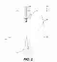Fig. 03 - Catheter with releasable balloon and related methods