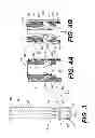 Fig. 04 - Catheter with releasable balloon and related methods