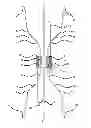Fig. 01 - Vena cava filter with dual retrieval