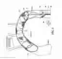 Fig. 03 - CLOT CAPTURE DEVICE