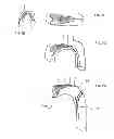 Fig. 06 - EMBOLIC PROTECTION SYSTEM AND METHOD FOR USE IN AN AORTIC ARCH