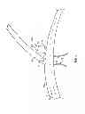 Fig. 02 - Flexible vascular occluding device