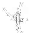 Fig. 07 - Flexible vascular occluding device