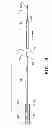 Fig. 07 - METHOD AND APPARATUS FOR CAPTURING OBJECTS BEYOND AN OPERATIVE SITE IN MEDICAL PROCEDURES