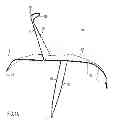 Fig. 02 - DEVICE AND METHOD FOR DEFLECTING EMBOLI IN AN AORTA