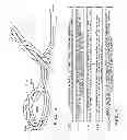 Fig. 05 - DEVICE AND METHOD FOR DEFLECTING EMBOLI IN AN AORTA
