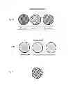 Fig. 09 - DEVICE AND METHOD FOR DEFLECTING EMBOLI IN AN AORTA