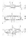 Fig. 03 - Percutaneous atrial and ventricular septal defect closure device
