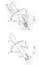 Fig. 10 - Percutaneous atrial and ventricular septal defect closure device
