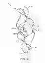 Fig. 15 - Percutaneous atrial and ventricular septal defect closure device