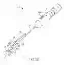 Fig. 16 - WOUND CLOSURE DEVICES AND METHODS OF USE