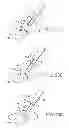 Fig. 18 - WOUND CLOSURE DEVICES AND METHODS OF USE