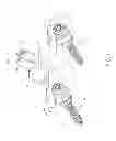 Fig. 02 - Interspinous vertebral and lumbosacral stabilization devices and methods of use