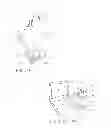 Fig. 35 - Interspinous vertebral and lumbosacral stabilization devices and methods of use