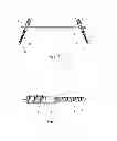 Fig. 02 - Implant for pelvic ring fractures