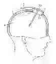 Fig. 01 - ANCHORING APPARATUS AND METHODS FOR USE