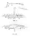 Fig. 02 - ANCHORING APPARATUS AND METHODS FOR USE