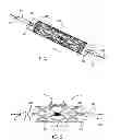 Fig. 02 - DELIVERY SYSTEM FOR BIFURCATION STENTS