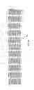 Fig. 02 - Flexible stent with improved axial strength
