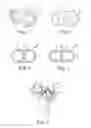 Fig. 02 - Multiple Orifice Implantable Heart Valve and Methods of Implantation