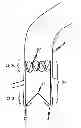 Fig. 01 - Device for the implantation and fixation of prosthetic valves