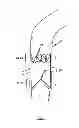 Fig. 02 - Device for the implantation and fixation of prosthetic valves