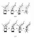 Fig. 04 - Device for the implantation and fixation of prosthetic valves