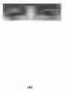 Fig. 02 - Eye aperture enhancing prosthesis and method