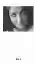 Fig. 09 - Eye aperture enhancing prosthesis and method
