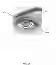 Fig. 49 - Eye aperture enhancing prosthesis and method